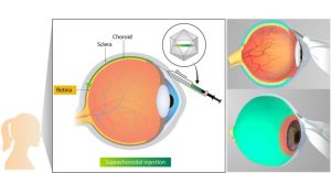 ophthalmology graphic 02 1 768x403 1